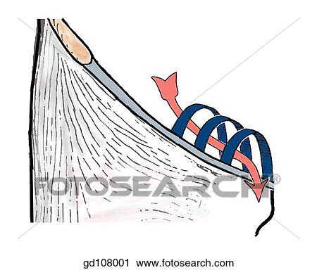 Contributions of the three flat abdominal muscles to the inguinal canal. View Large Illustration Clip Art - Contributions of the three flat abdominal muscles to the inguinal canal.. Fotosearch