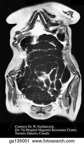Coronal magnetic resonance images (MRI) of abdomen. View Large Illustration Clip Art - Coronal magnetic resonance images (MRI) of abdomen.. Fotosearch