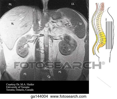 Coronal MRI of the abdomen. Image at right shows level of scan (line D). View Large Illustration Stock Illustration - Coronal MRI of the abdomen. Image at right shows level of scan (line D).. Fotosearch