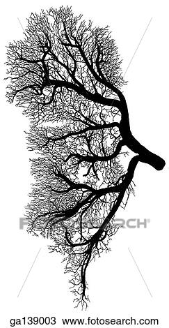 Corrosion cast of posterior segmental artery of the kidney. View Large Illustration Drawing - Corrosion cast of posterior segmental artery of the kidney.. Fotosearch