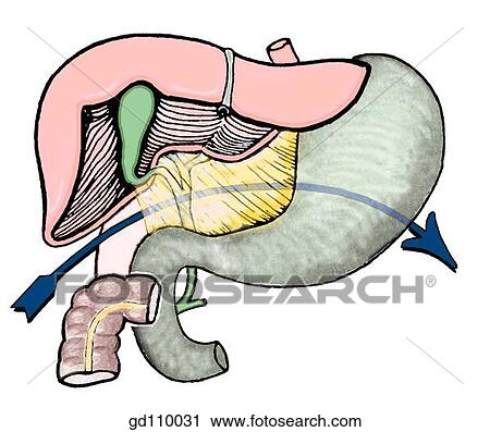 Clip Art - Entrance into omental bursa (lesser sac) through omental (epiploic) foramen. The blue line of the arrow passes through the omental bursa and posterior to the stomach.. Fotosearch