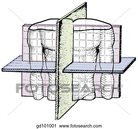 Clip Art - Fundamental planes in the body: sagittal, coronal, and transverse.. Fotosearch