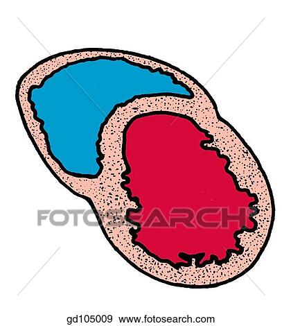 Horizontal section through right and left ventricles. Arrow indicate sagittal plane. View Large Illustration Stock Illustration - Horizontal section through right and left ventricles. Arrow indicate sagittal plane.. Fotosearch