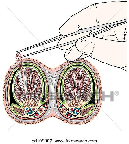 Stock Illustration - Horizontal section through right and left halves of scrotum. Schematic view of seminiferous tubule being pulled from lobule of testis (schematic; enlarged).. Fotosearch