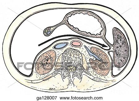 Stock Illustration - Inferior view of transverse section of omental bursa. Arrow passes from greater sac through the omental foramen into the omental bursa (lesser sac).. Fotosearch