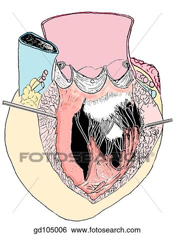 Stock Illustration - Interior of left ventricle.. Fotosearch