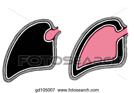 Invagination of developing heart into layers of pericardium. View Large Illustration Stock Illustration - Invagination of developing heart into layers of pericardium.. Fotosearch