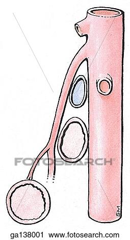 Lateral schematic illustration showing the relationships of left renal vein and third part of duodenum to aorta and superior mesenteric artery. View Large Illustration Clip Art - Lateral schematic illustration showing the relationships of left renal vein and third part of duodenum to aorta and superior mesenteric artery.. Fotosearch