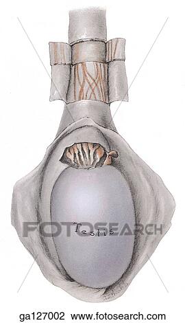 Drawing - Lateral view of coverings of spermatic cord, layers incised and pulled back.. Fotosearch