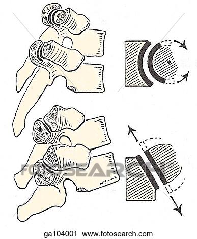 Lateral view of the 6th and 7th and 8th and 9th thoracic vertebrae demonstrating how the costotransverse joints rotate in the 6th and 7th vertebrae while they glide in the 8th and 9th. View Large Illustration Clip Art - Lateral view of the 6th and 7th and 8th and 9th thoracic vertebrae demonstrating how the costotransverse joints rotate in the 6th and 7th vertebrae while they glide in the 8th and 9th.. Fotosearch
