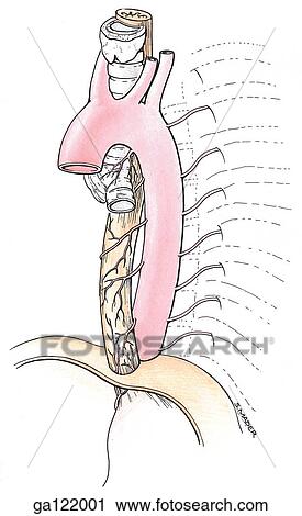 Left anterolateral view of the arch of the aorta and the many branches of arteries which arise from the thoracic aorta to provide arterial blood supply to the trachea and esophagus. View Large Illustration Clip Art - Left anterolateral view of the arch of the aorta and the many branches of arteries which arise from the thoracic aorta to provide arterial blood supply to the trachea and esophagus.. Fotosearch