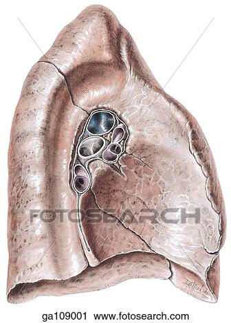 Medial view of the mediastinal (medial) surface of the left lung