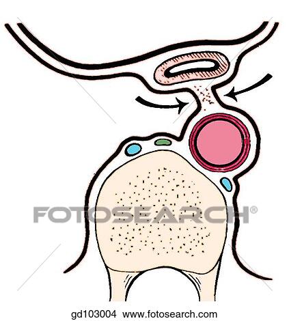 Mediastinal layers of pleura. View Large Illustration Stock Illustration - Mediastinal layers of pleura.. Fotosearch