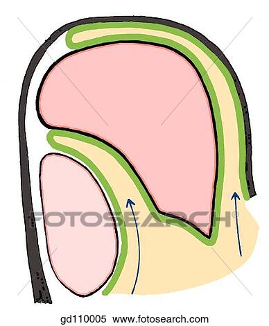 Paramedian section through diaphragm, liver and right kidney. Subphrenic recess and hepatorenal recess or pouch (of Morrison). View Large Illustration Stock Illustration - Paramedian section through diaphragm, liver and right kidney. Subphrenic recess and hepatorenal recess or pouch (of Morrison).. Fotosearch