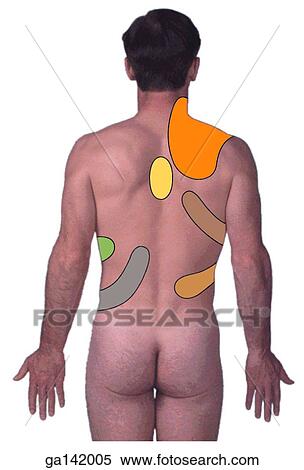 Photo of an posterior view of an adult male onto which areas of visceral pain have been projected. View Large Illustration Stock Illustration - Photo of an posterior view of an adult male onto which areas of visceral pain have been projected.. Fotosearch