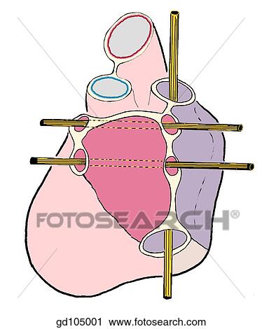 Posterior aspect of heart in anatomical positions. View Large Illustration Clip Art - Posterior aspect of heart in anatomical positions.. Fotosearch
