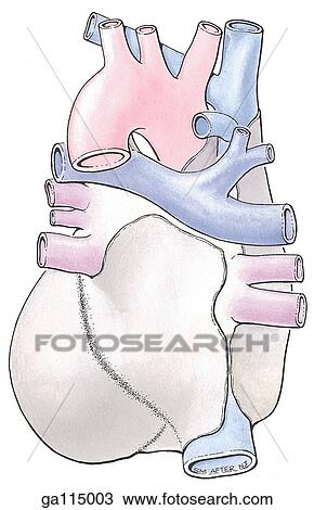 Drawing - Posterior view of the heart with pericardium and great vessels.. Fotosearch