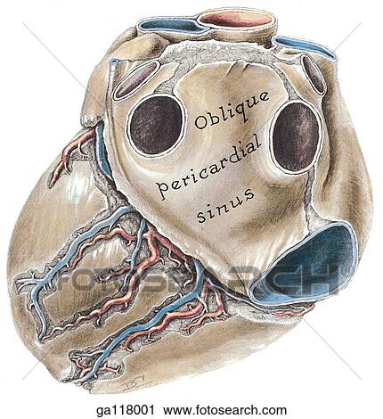 Posteroinferior view of heart with entire base and part of diaphragmatic surface in view. A portion of the pericardial sac has been removed to reveal cardiac veins and arteries. View Large Illustration Clip Art - Posteroinferior view of heart with entire base and part of diaphragmatic surface in view. A portion of the pericardial sac has been removed to reveal cardiac veins and arteries.. Fotosearch