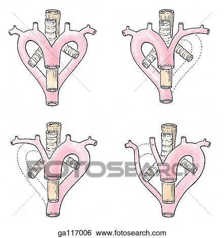 Quatre Variations De Les Voute Aortique Are Shown Double Voute Aortique De Les Frog Droit Voute Aortique De Les Bird Gauche Voute Aortique De Les Mammifere Inclure Homme Et A Variante A