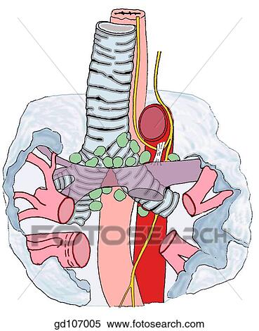 Radiograph of left lateral chest (digitally enhanced) and related anatomical structures. View Large Illustration Stock Illustration - Radiograph of left lateral chest (digitally enhanced) and related anatomical structures.. Fotosearch