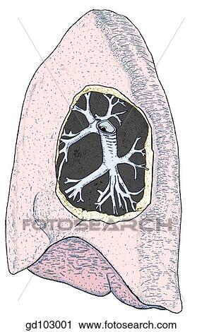 Right bronchial tree. The segmental bronchi are labled as follows: 1, apical; 2, posterior; 3, anterior; 4, lateral; 5, medial; 6, superior; 7, medial basal; 8, anterior basal; 9, lateral basal; 10, posterior basal. View Large Illustration Clip Art - Right bronchial tree. The segmental bronchi are labled as follows: 1, apical; 2, posterior; 3, anterior; 4, lateral; 5, medial; 6, superior; 7, medial basal; 8, anterior basal; 9, lateral basal; 10, posterior basal.. Fotosearch