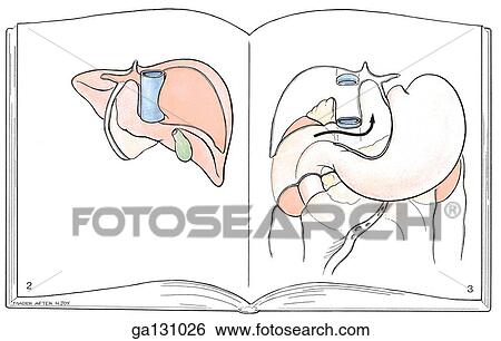 Schematic illustration of posterior surface of liver. Liver pictured on left page in a book with underlying anatomy featured on right. View Large Illustration Stock Illustration - Schematic illustration of posterior surface of liver. Liver pictured on left page in a book with underlying anatomy featured on right.. Fotosearch