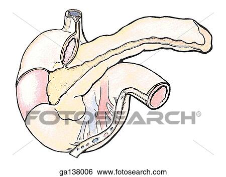 Schematic illustration of the duodenum and pancreas illustrating the peritoneum and corresponding "bare areas. " View Large Illustration Stock Illustration - Schematic illustration of the duodenum and pancreas illustrating the peritoneum and corresponding "bare areas. ". Fotosearch