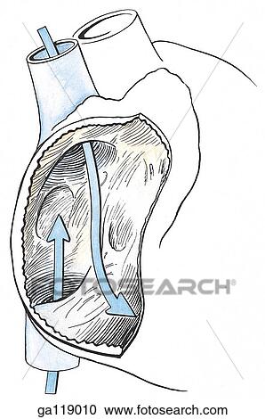 Schematic illustration of the right atrium showing the inflow of blood from the superior and inferior vena cava. View Large Illustration Clipart - Schematic illustration of the right atrium showing the inflow of blood from the superior and inferior vena cava.. Fotosearch