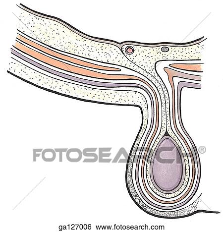 Schematic of horizontal section of inguinal canal and testis. Drawing shows eight layers of abdominal wall and three evaginations: scrotum, coverings of spermatic cord, and constituents of the cord. View Large Illustration Stock Illustration - Schematic of horizontal section of inguinal canal and testis. Drawing shows eight layers of abdominal wall and three evaginations: scrotum, coverings of spermatic cord, and constituents of the cord.. Fotosearch