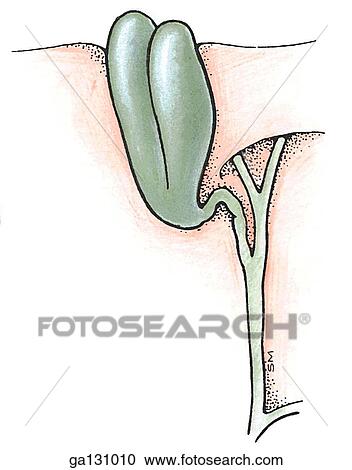 Simple drawing of a double gallbladder. View Large Illustration Clipart - Simple drawing of a double gallbladder.. Fotosearch