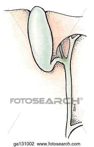 Drawing - Simple drawing showing an accessory hepatic duct joining the cystic duct.. Fotosearch