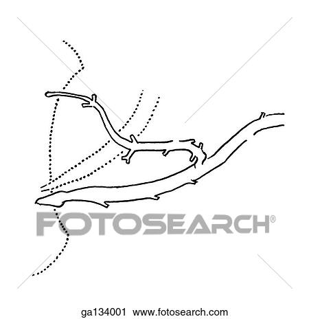 Clip Art - Simple line drawing of a common variation of pancreatic duct where an accessory duct is large enough to relieve an obstructed main duct.. Fotosearch