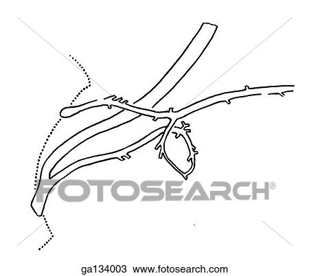 Drawing - Simple line drawing of a common variation of pancreatic duct where an accessory duct is of medium size but probably large enough to substitute for the main duct.. Fotosearch