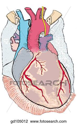 Sternocostal surface of heart and vessels in situ. L. A. D. (left anterior descending branch of left coronary artery). View Large Illustration Drawing - Sternocostal surface of heart and vessels in situ. L. A. D. (left anterior descending branch of left coronary artery).. Fotosearch