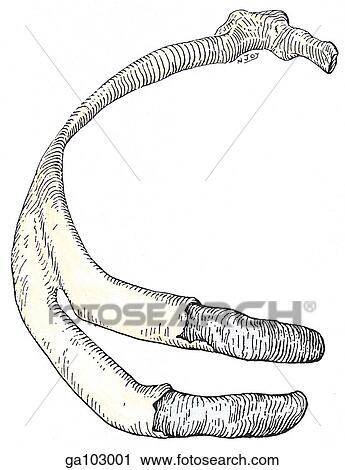 Superior view of a bicipital rib. In this case there has been partial fusion of the first two thoracic ribs. View Large Illustration Clip Art - Superior view of a bicipital rib. In this case there has been partial fusion of the first two thoracic ribs.. Fotosearch