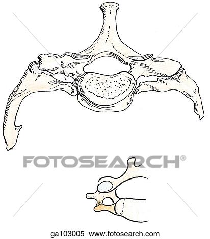 Superior view of a cervical vertebrae with an enlarged costal element (top). Bottom image shows a normal situation. View Large Illustration Stock Illustration - Superior view of a cervical vertebrae with an enlarged costal element (top). Bottom image shows a normal situation.. Fotosearch