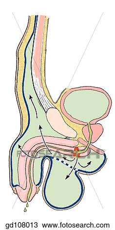 The membranous layer of the superficial fascia (Scarpa's fascia) and its continuation with the fasciae of the scrotum and perineum. Extravasation of urine along fascial boundaries (following injury and perforation of male urethra). View Large Illustration Drawing - The membranous layer of the superficial fascia (Scarpa's fascia) and its continuation with the fasciae of the scrotum and perineum. Extravasation of urine along fascial boundaries (following injury and perforation of male urethra).. Fotosearch