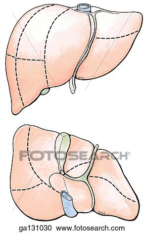 Clipart - Two simple drawings of the liver, anterior view (top), posteroinferior view (bottom). In both, the segments of the liver are identified by Roman numerals.. Fotosearch