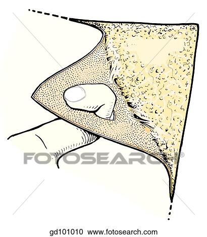 Clipart - When removing skin, apply traction.. Fotosearch