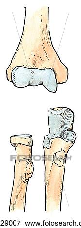 Anterior view of the bones of the elbow; the image at the top is the humerus, the bottom left image is the radius, and the bottom right image is the ulna. View Large Illustration Stock Illustration - Anterior view of the bones of the elbow; the image at the top is the humerus, the bottom left image is the radius, and the bottom right image is the ulna.. Fotosearch