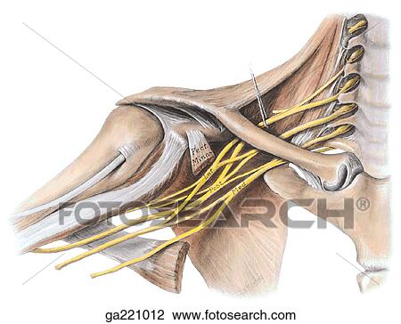 Anterior view of the brachial plexus and ligaments of the clavicle with the pectoralis minor muscle cut away. View Large Illustration Drawing - Anterior view of the brachial plexus and ligaments of the clavicle with the pectoralis minor muscle cut away.. Fotosearch