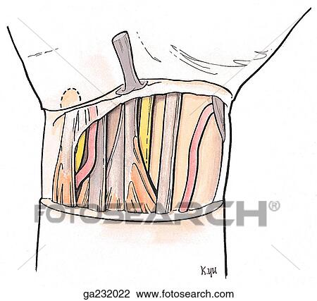 Anterior view of the structures of the wrist. View Large Illustration Drawing - Anterior view of the structures of the wrist.. Fotosearch