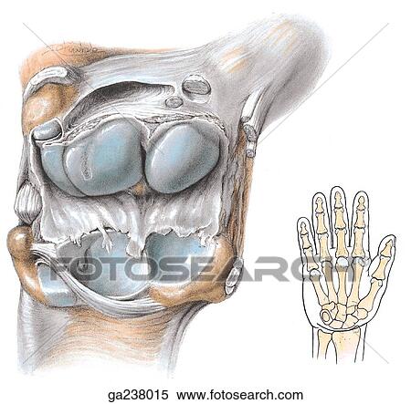 Stock Illustration - Anterior view of the surfaces of radiocarpal (wrist) joint; image on left shows the structures of the hand and wrist superimposed on outline of hand.. Fotosearch