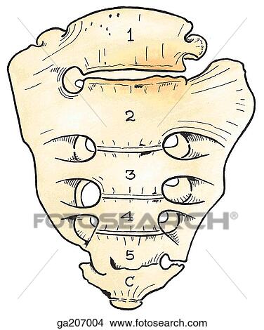 Anterior view of transitional lumbosacral vertebra, with the 1st sacral vertebra partly free (lumbarized) and the 5th lumbar vertebral partly fused to sacrum (sacralized). View Large Illustration Stock Illustration - Anterior view of transitional lumbosacral vertebra, with the 1st sacral vertebra partly free (lumbarized) and the 5th lumbar vertebral partly fused to sacrum (sacralized).. Fotosearch