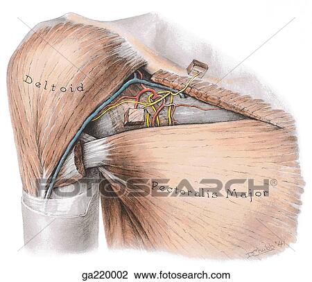 Drawing - Anterior wall of the axilla and clavipectoral fascia, with superficial layers and clavicular head of pectoralis major excised.. Fotosearch