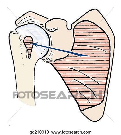 Attachments to subscapularis muscle. View Large Illustration Clipart - Attachments to subscapularis muscle.. Fotosearch