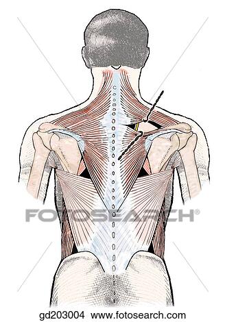Exposure of dorsal scapular region. View Large Illustration Stock Illustration - Exposure of dorsal scapular region.. Fotosearch