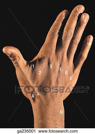 Hand and wrist. (H) ulnar head, (E) ext. digit. long. tend., (A) snuff box, (1) add. pollicis, (2) 1st dorsal interosseous, (3) ext. pollicis longus, (4) abd. pollicis long., (5) ext. pollicis brevis. View Large Illustration Clip Art - Hand and wrist. (H) ulnar head, (E) ext. digit. long. tend., (A) snuff box, (1) add. pollicis, (2) 1st dorsal interosseous, (3) ext. pollicis longus, (4) abd. pollicis long., (5) ext. pollicis brevis.. Fotosearch