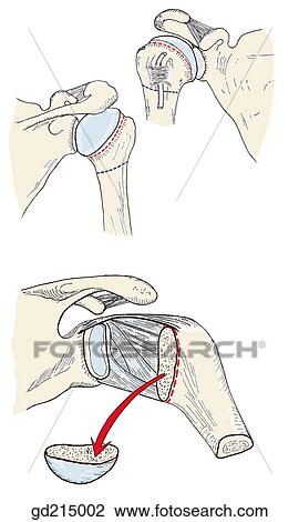 Interior of right shoulder joint exposed from posterior aspect. View Large Illustration Drawing - Interior of right shoulder joint exposed from posterior aspect.. Fotosearch