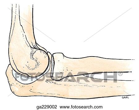 Drawing - Lateral view of the elbow joint showing capitulum, lateral epicondyle, and head, neck, and tuberosity of radius.. Fotosearch